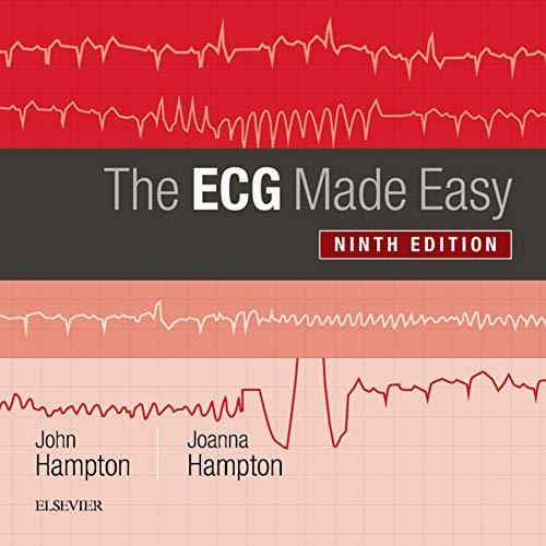 The ECG Made Easy  